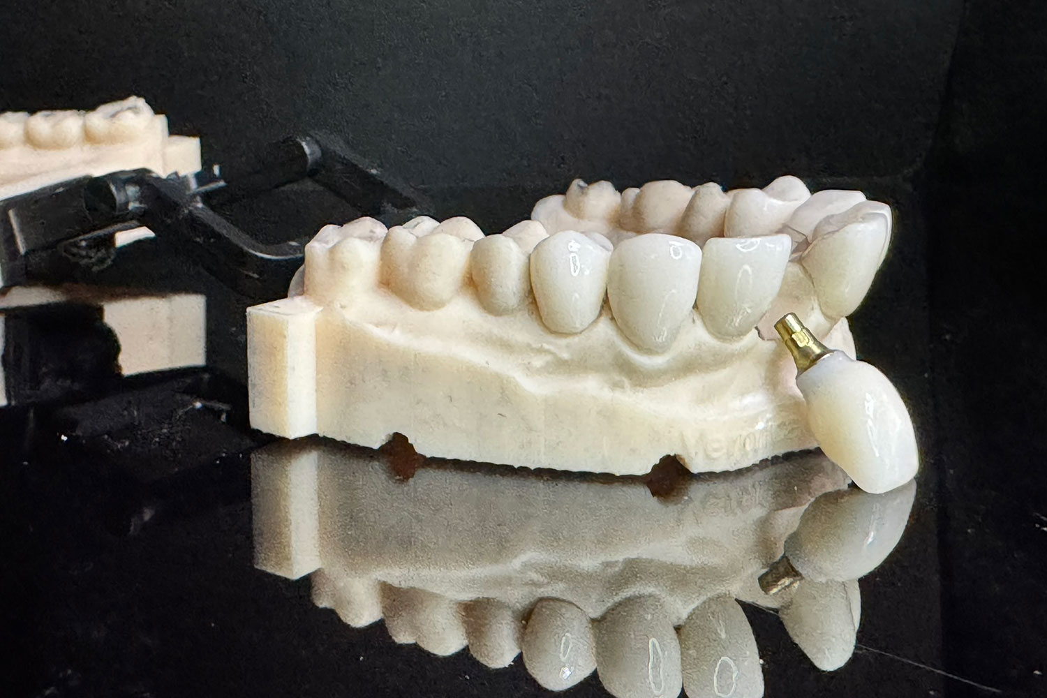 Preventative Dentistry